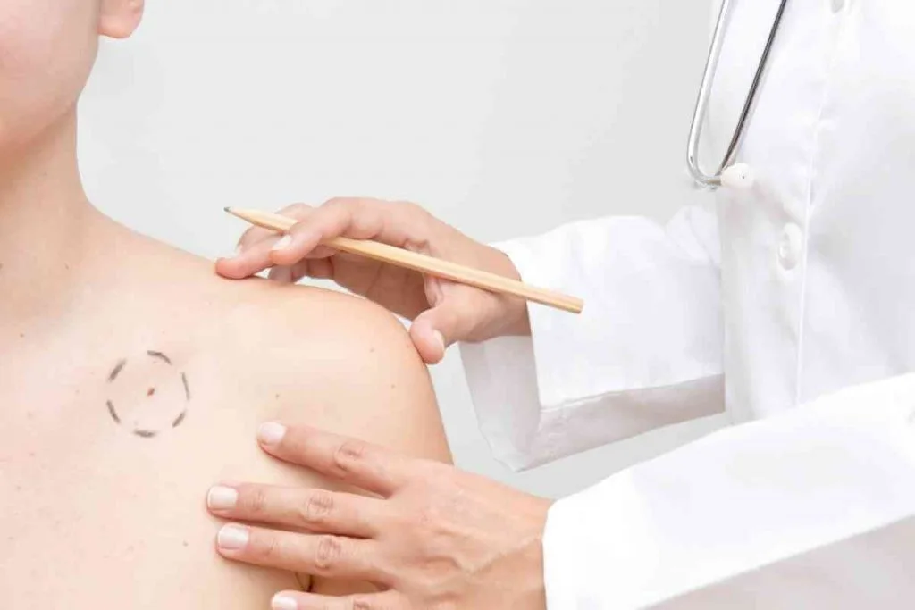 cuidados-pos-cirurgia-cancer-pele