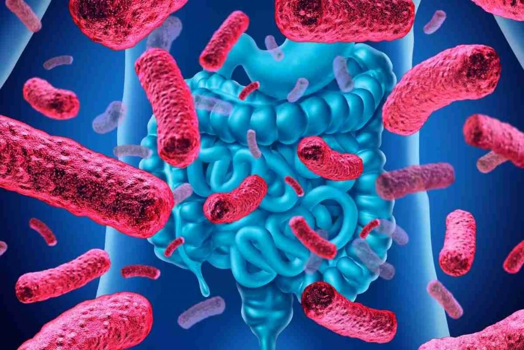 infeccao-apos-cirurgia-de-intestino