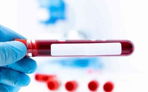 teste Galleri - exame de sangue para triagem de câncer