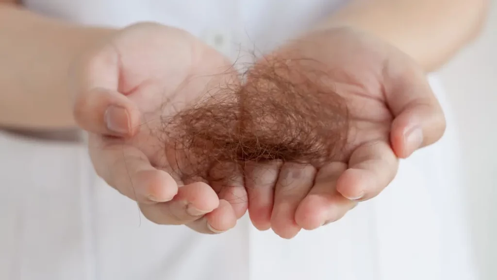 Perguntas frequentes sobre queda de cabelo pode ser sintoma de câncer (FAQs)